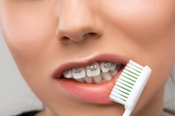 Pielęgnacja jamy ustnej przy noszeniu aparatu ortodontycznego: praktyczne porady